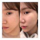 안산에스테틱 중앙역피부관리 라온제나 에스테틱 오투덤 수분 케어 합리적 가격 효과 대만족