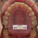 연세미소담은치과 이미지