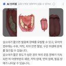 57 | [충남천안/두정동] 아이힐소아과 57일 아기 설소대 시술 후기