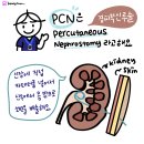 PCN 이미지
