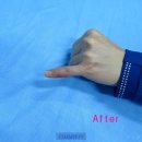 강남챔피언정형외과의원 이미지