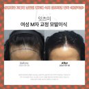 천안시성형외과 고를때 남발된 광고에 속지 않으려면 필독 &lt;원장작성&gt;