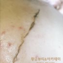 귀족피부관리