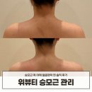 핸드경락 마사지 | 얼굴경락 위뷰티 목피부관리 승모근관리 직각어깨 솔직 후기