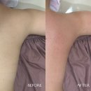 시크릿라인 | 부산 서면에스테틱 시크릿라인 | 윤곽관리 내돈내산 후기