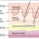 [화상] 화상특별약관에 대하여 이미지