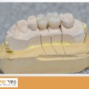 다이안치과기공소 이미지