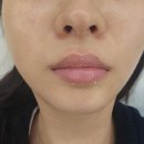 4556 | 강남입술문신 잘하는곳 추천! 입술문신1차 후기 '에이샵뷰티'