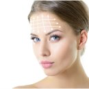 닥터디자이너의원 광주점 | 닥터디자이너 광주 이마필러, 입체감 있는 동그란 이마를 원한다면?