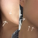 안양다이어트한의원 처방약 일주일 -3.9kg 감량 후기 식단 몸무게 얼굴 변화?