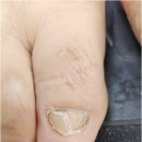 완월동152 | 마산 완월동 발톱무좀 깨끗하게 없애주는 네일팝 페디크루