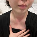 양준상의원 | 양준상의원 알러지 10개월차 후기(+자주 묻는 질문)