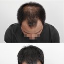 리게인프로젝트 부산점 이미지