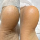 J-2 | 안성왁싱 및 피부관리 시술 J왁싱뷰티 2호점에서 패디플래닝 후기