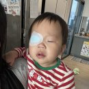 신현진 | 건대 신현진 교수 안과 조절성내사시 진단후기(ing)