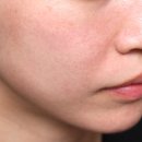 가곡초등학교 | 마곡피부과 안아픈 리프팅 찾다가 세르프 선택한 이유 (600샷 후기)