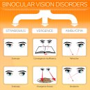 Re: 파킨슨 병 .. Visual Dysfunction in Parkinson’s Disease 2023년 논문... 이미지