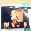 지더블유앤트러스트 | 구하나 일기 :: 여덟번째 검진, 임신 27주 / 임당검사, 백일해주사, 조리원예약 / 이사완료, 1kg 넘은...