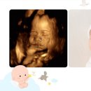 테헤란체리산부인과의원 | [18~24주] 임산부 수영 | 포근담 산부인과 입체 정밀 초음파 후기