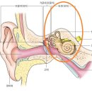 독일지멘스보청기 이미지