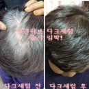 익산영등동 빽스테라피