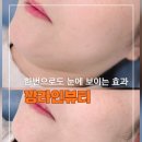 풍무역 | [경기/김포]풍무역 이중턱 관리 후기 한번만으로도 확실한 효과!