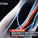 EBS 교육방송(명의) 신장과 혈관 이미지