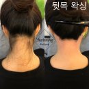 챠밍헤어라인 이미지