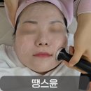 유성메디칼케어 네이버블로그