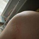강동고은빛 산부인과 자연분만 후기 (동메아리원장님)/자연진통 너무괴로워..세상에서 제일심각한 대왕...