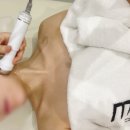 제니프 | [용산에스테틱 추천 "제니프에스테틱"] 효과보고 깜짝..!! 재방문 의사 150%!