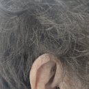 군산유니트론보청기 이미지