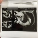 마미안여성병원 | [일상] 임신 28주차 기록