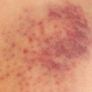 도화요양병원 이미지