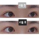 연신내약국 | 연신내 속눈썹 빠른시간안에 대만족 멜로즈뷰티