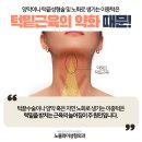 이중턱없애는방법 이중턱지방흡입 이중턱수술 중 효과적인 이중턱리프팅 방법은 이미지