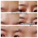 에띠미 | 에띠미뱀독2종화장품 뱀독펩타이드진실후기-광순이