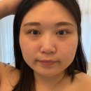 (주)제노필 | [피부관리] 피부 컨디션에 맞는 1:1 맞춤 관리 추천, 쌍촌동 피부관리는 '루에아뷰티'