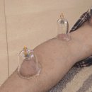 뜰한의원 | 어깨뭉침 심해서 한의원 부항 생각날 때, 집에서 쓰는 오웰 부항기 사용 후기