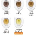 남천병원 | 대장내시경 위내시경 수면마취 주의할점(남천병원 vvip 건강검진 후기)