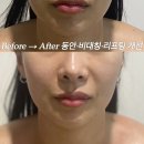 안산BP