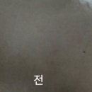 강리현스킨바디
