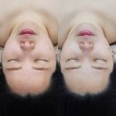 대구 에스테틱 물오른피부 겨울철 수분케어로 물광피부 완성