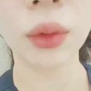 로젠성형외과의원 네이버블로그