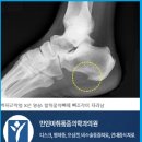 만인마취통증의학과의원 네이버블로그