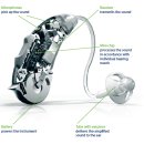 다음보청기 이미지