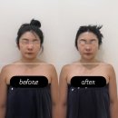 광주북구피부관리 추천 | 이플에스테틱 하이퍼소닉 광주윤곽관리 후기