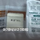 파리바게뜨한강성심병원 | 0세 아기 화상치료 한강성심병원 응급실 치료후기 아기화상대처법