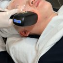 소프라노의원 | 용산구피부과 티타늄 리프팅 내돈내산 후기 레이저 부작용 주기