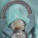 SKY치과기공소 이미지